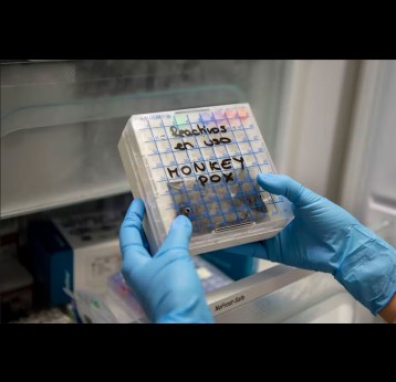A lab technician in Spain picks up a reactive to test suspected monkeypox samples. Pablo Blazquez Dominguez/Getty Images