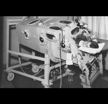 A child is treated in an early version of the iron lung at Children’s Hospital Boston in 1932. Credit Courtesy of March of Dimes