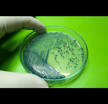 A petri dish with growth of candida albicans, another candida variant.