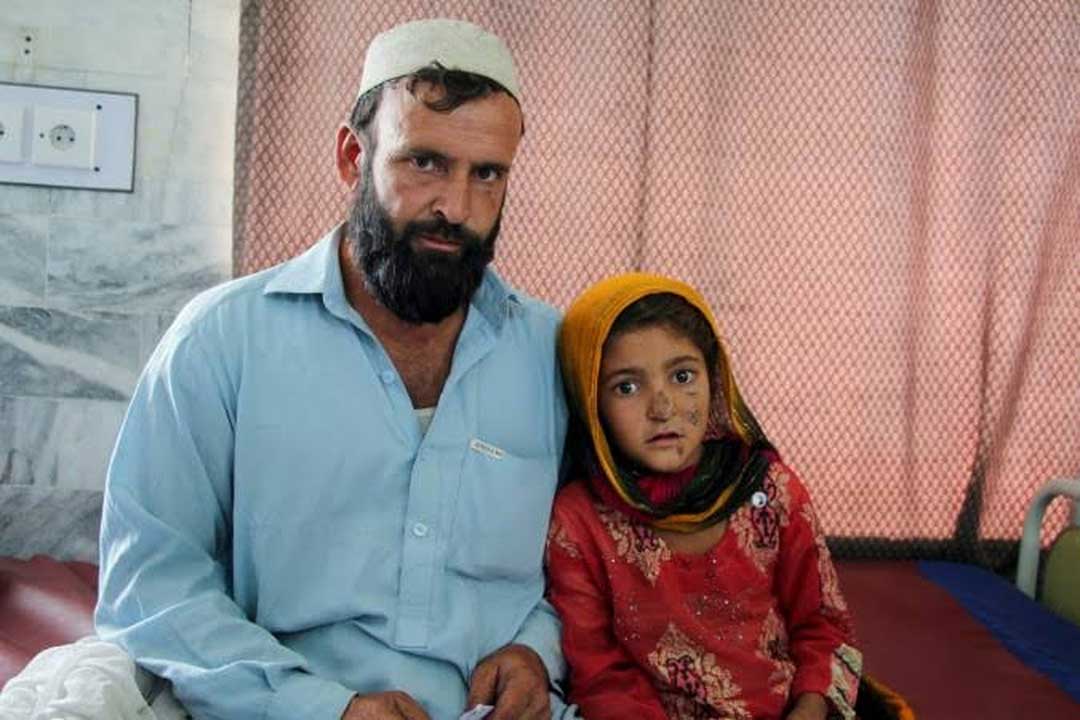 A father with his daughter at the MSF's leishmaniasis center in Khyber Pakhtunkhwa. Credit MSF Pakistan