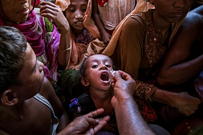 A Rohingya child receives the oral cholera vaccine at Shafullarkata refugee camp in Cox’s Bazar, Bangladesh. In 2017, Gavi funded one of the largest cholera vaccination campaigns in history to protect nearly a million people against the disease in camps and surrounding areas. Working on the principle that no child should be denied the right to good health, including access to life-saving vaccines, the Alliance continues to support routine immunisation at the camps.
