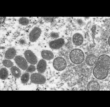 Micrographie électronique de particules de virus de la variole du singe isolés en 2003 aux États-Unis, dans des échantillons humains (à gauche, les virus matures, ovales, à droite les virus immatures, ronds). Cynthia S. Goldsmith, Russell Regner / CDC / AP