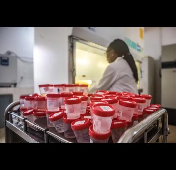 Scientist analyses flasks of saliva of TB patients. Credit: Yanick Folly/AFP via Getty Images