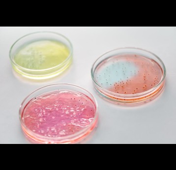 Close up of petri dishes. Credit: Edward Jenner / Pexels