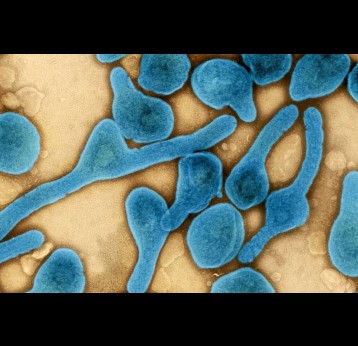 Micrographie électronique à transmission colorisée de particules du virus de Marburg (bleu, fausses couleurs) récoltées dans le surnageant de cellules VERO E6 infectées. NIAID - Integrated Research Facility à Fort Detrick, Maryland, États-Unis.