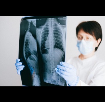 Doctor looking at an x-ray picture of lungs. Credit: Anna Shvets on Pexels