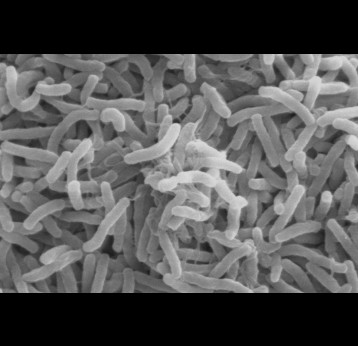Cholera bacteria. Credit: Wikimedia commons