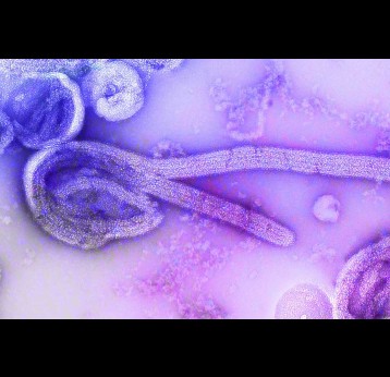 electron microscopic image of the 1976 isolate of Ebola virus. Credit: CDC on Unsplash