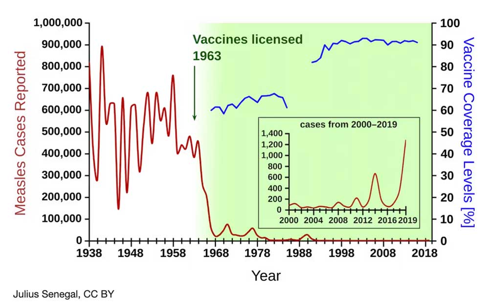 Measles cases in the US, 1938–2019