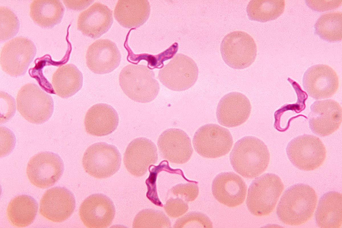 A light microscope image shows ribbony trypanosome parasites and disc-shaped human blood cells against a pink background.