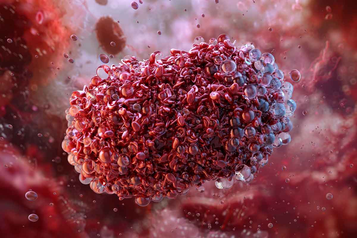 Monkeypox virus, a zoonotic orthopoxvirus causing a smallpox illness. Viral structure of the pathogen monkeypox, variola mpox virus disease. Credit: Corona Borealis