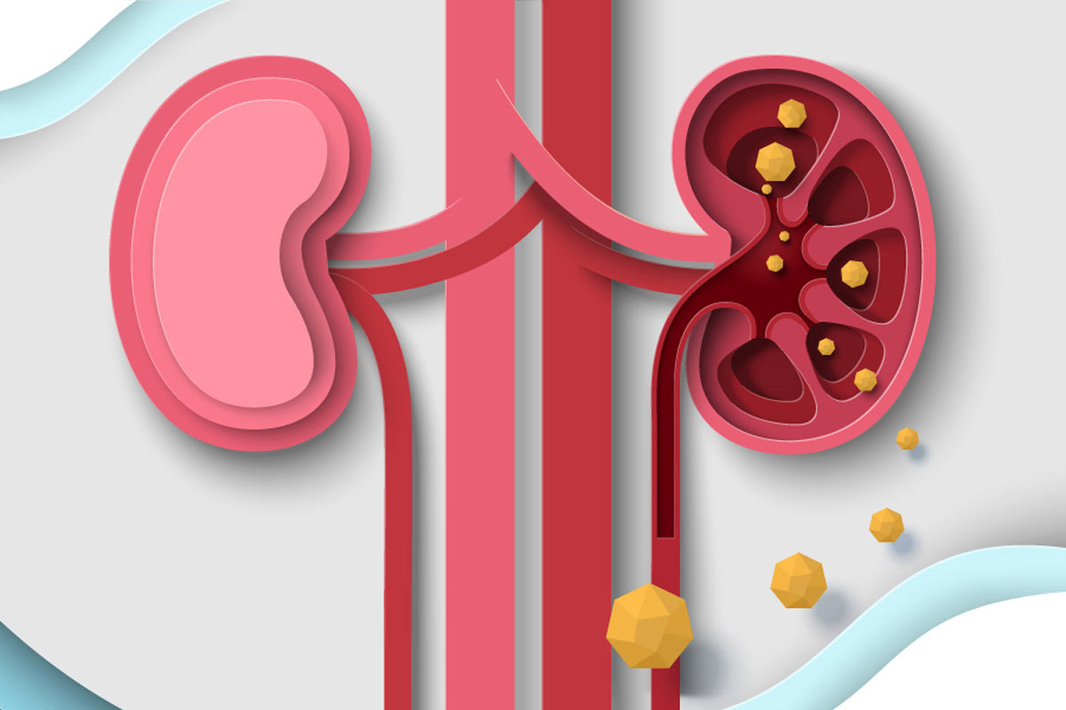 A drug in development could help to correct a kidney disease disparity. CREDIT: ADAPTED FROM SIBERIAN ART / SHUTTERSTOCK