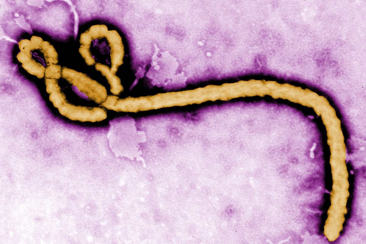 The Ebola virus. Credit: CDC