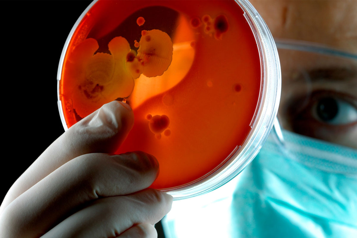 Scientist examining petri dish of bacteria. Credit: E+ via Getty Images