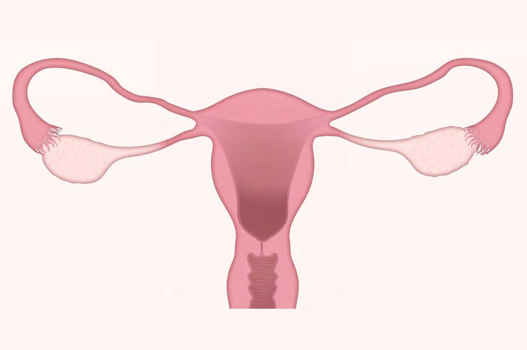 Uterus, cervix and ovaries. Credit: LJNovaScotia from Pixabay